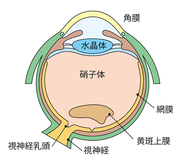 黄斑上膜（黄斑前膜）とは